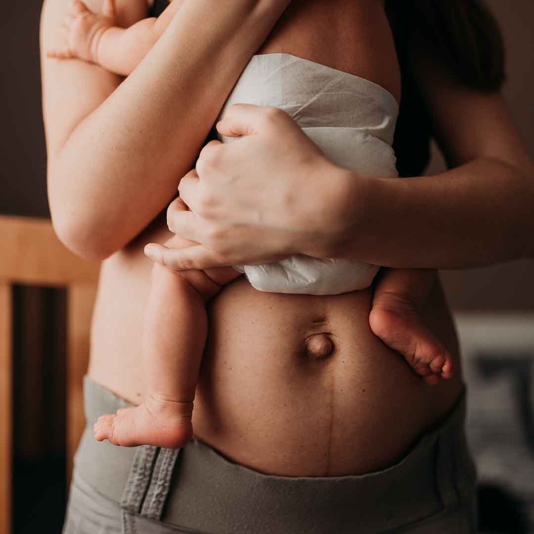 121 Physical Therapy Clarkston, Michigan New Mom with Baby and after pregnancy belly